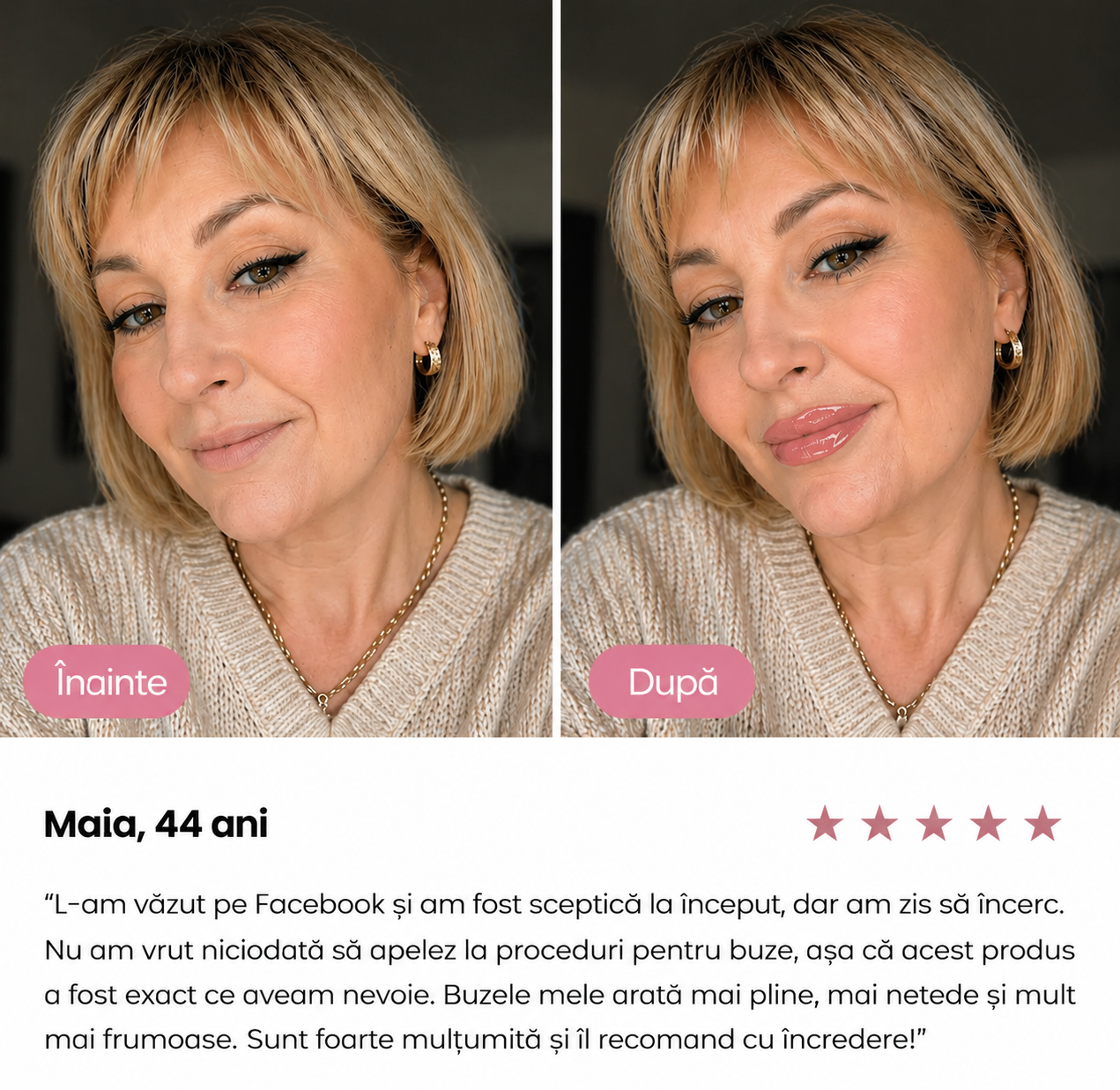 Lip Plumper™ – Gloss pentru buze cu efect de volum